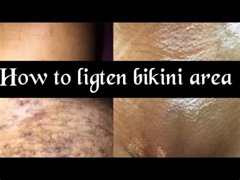 dark spots after shaving|dark bikini area from shaving.